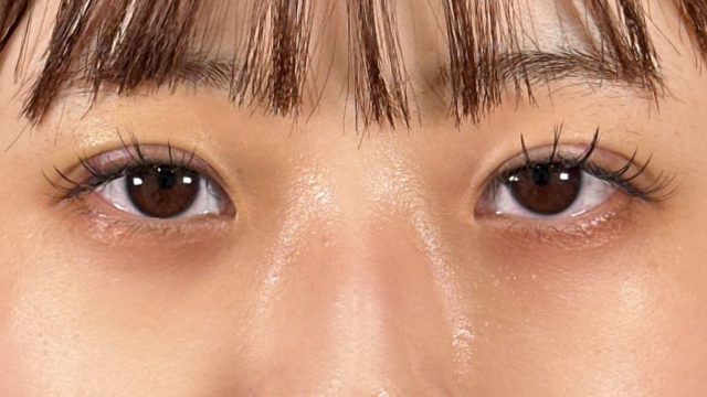 手术前的状态 其一