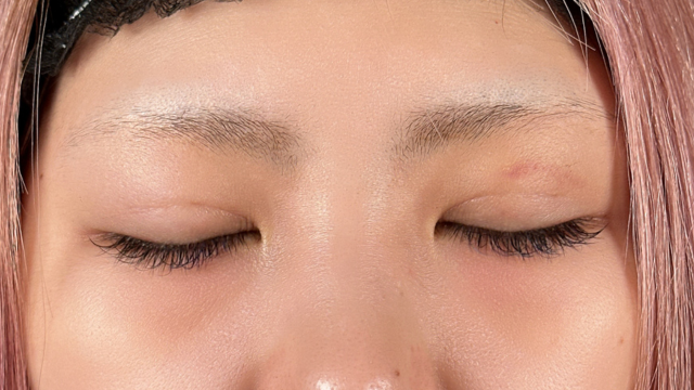 手术前的状态 其一