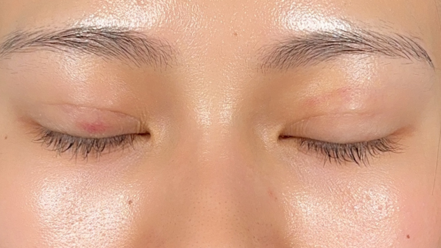 手术前的状态 其一