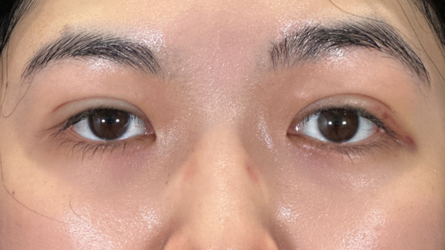 手术前的状态 其一