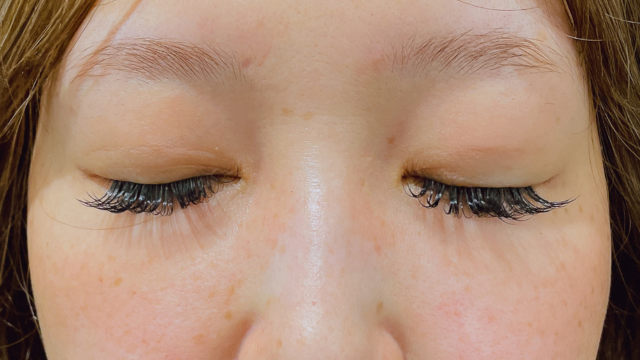 手术前的状态 其一