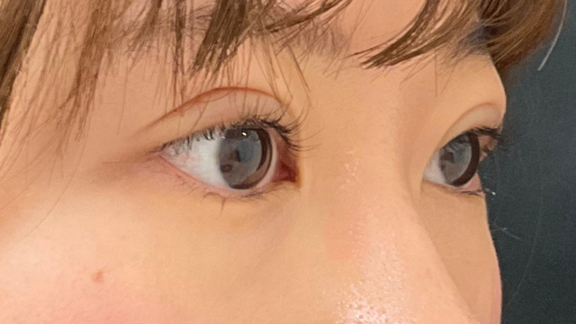 手术前的状态 其一