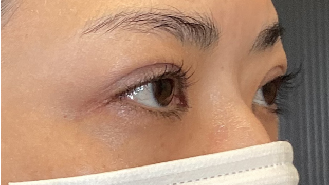 手術前の状態 その1