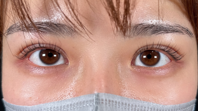 手术前的状态 其一