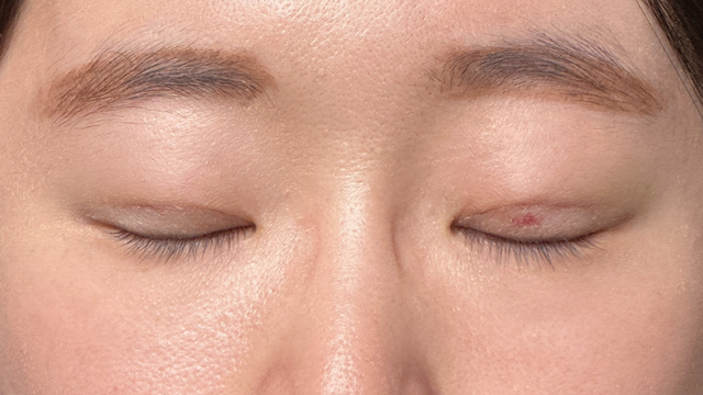 Postoperative Condition Part 1