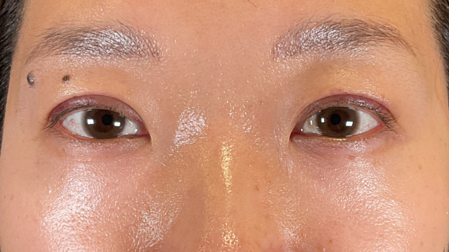 Postoperative Condition Part 1