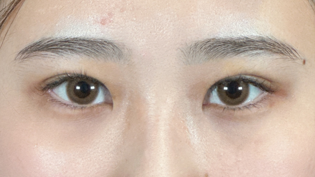 手术前的状态 其一