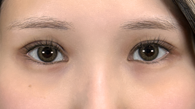 手术前的状态 其一