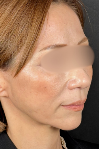 手術前の状態 その1