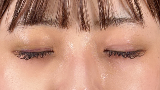 手术前的状态 其一