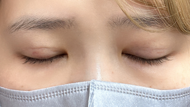 手术前的状态 其一