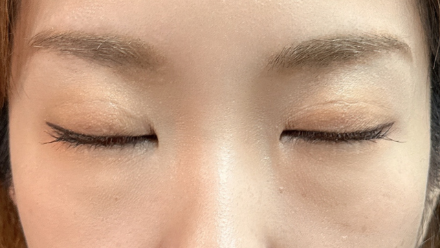 手术前的状态 其一