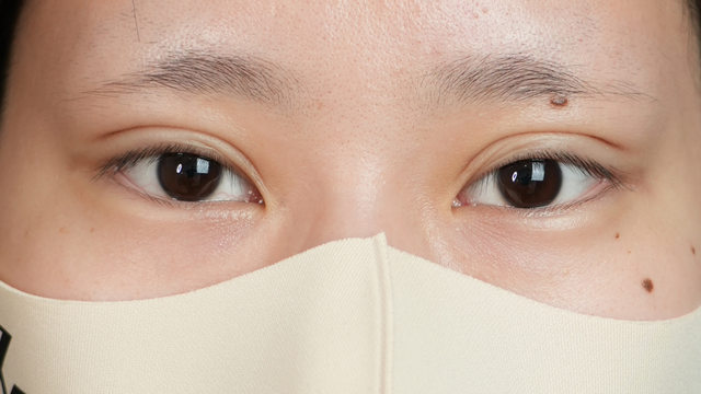 Postoperative Condition Part 1