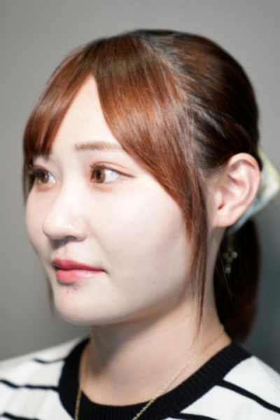 手術前の状態 その1