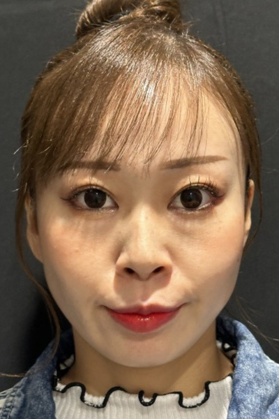 手术前的状态 其一