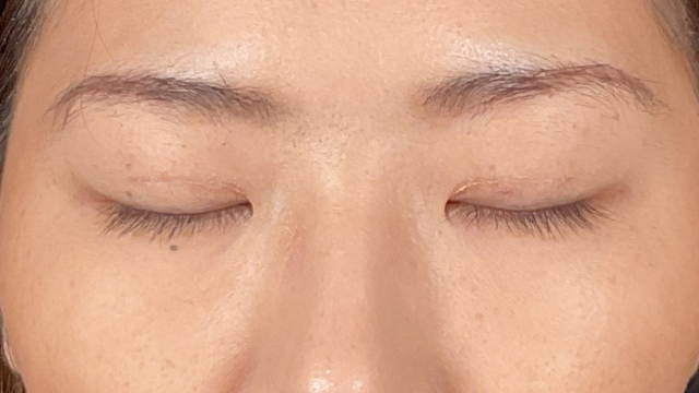 手术前的状态 其一