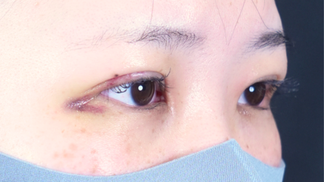 Postoperative Condition Part 1