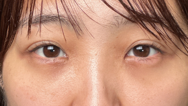 Postoperative Condition Part 1