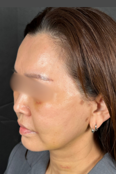 手术前的状态 其一