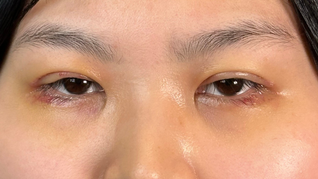 手术前的状态 其一