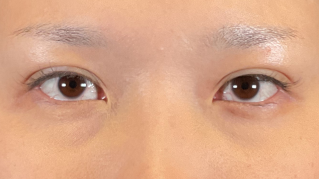 Postoperative Condition Part 1