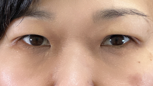 Postoperative Condition Part 1