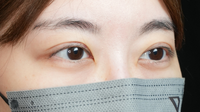 手术前的状态 其一