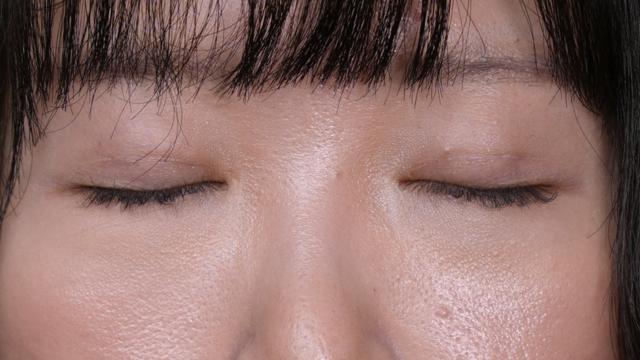 手术前的状态 其一