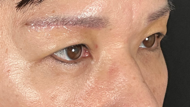 Postoperative Condition Part 1