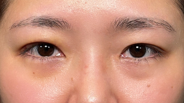 手术前的状态 其一