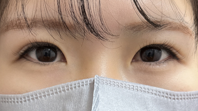 手术前的状态 其一