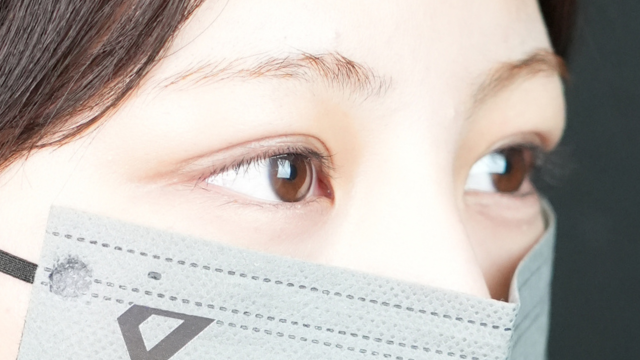 手術前の状態 その1