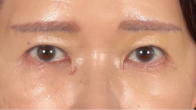 手術前の状態 その1