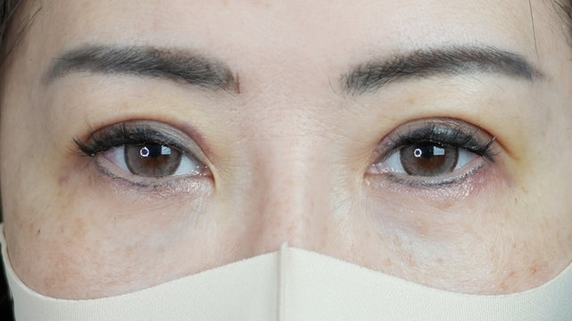 Postoperative Condition Part 1