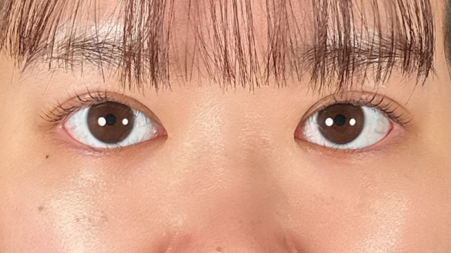 手术前的状态 其一