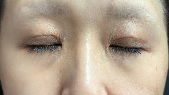 Postoperative Condition Part 1