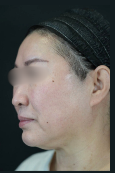 Postoperative Condition Part 1