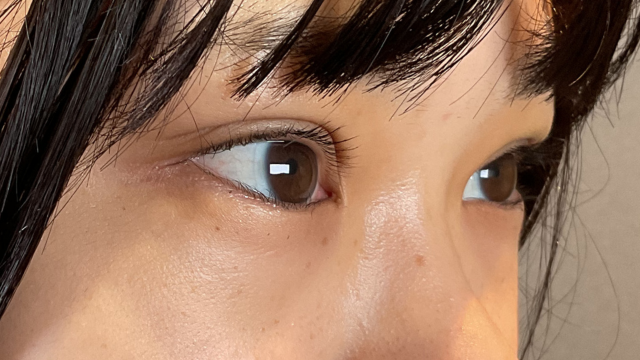 手术前的状态 其一