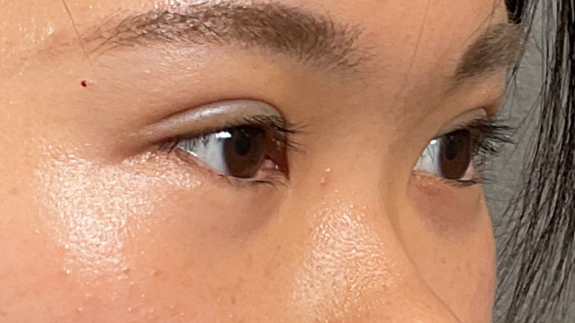 手术前的状态 其一