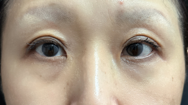 Postoperative Condition Part 1