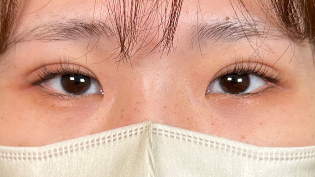 手术前的状态 其一