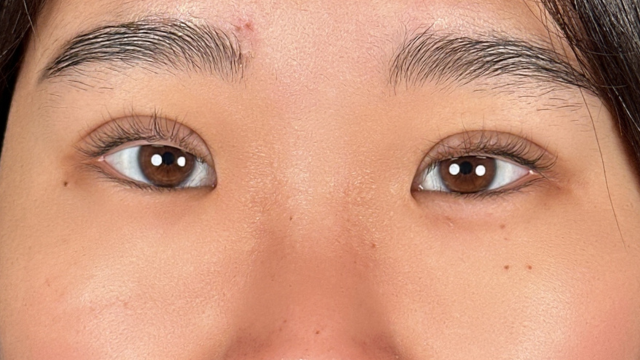 手术前的状态 其一