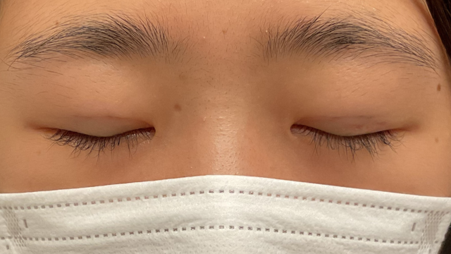 Postoperative Condition Part 1