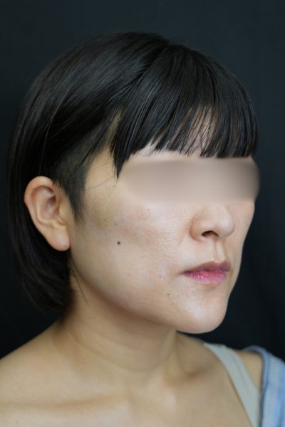 手术前的状态 其一