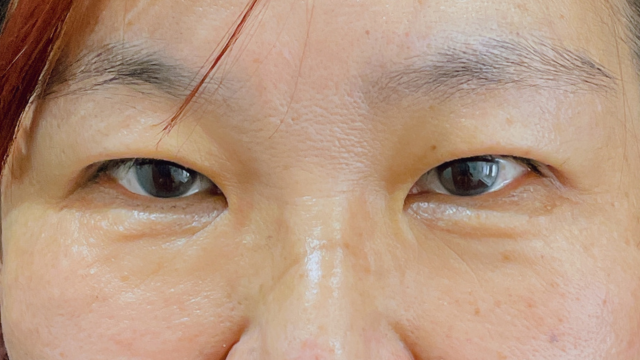 Postoperative Condition Part 1