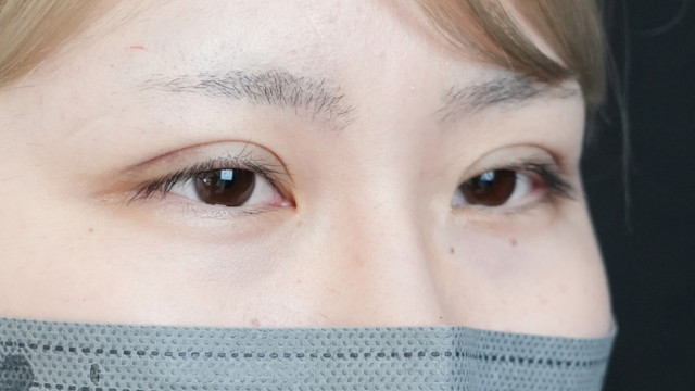 手术前的状态 其一