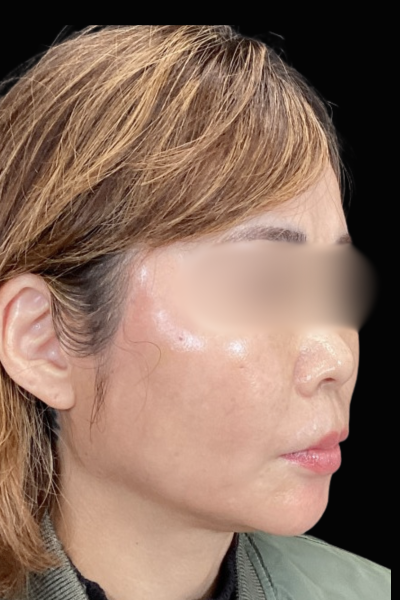 手術前の状態 その1