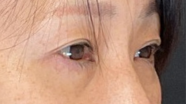 手术前的状态 其一