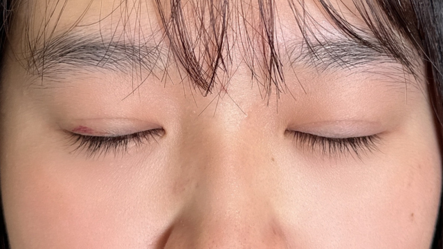 手术前的状态 其一