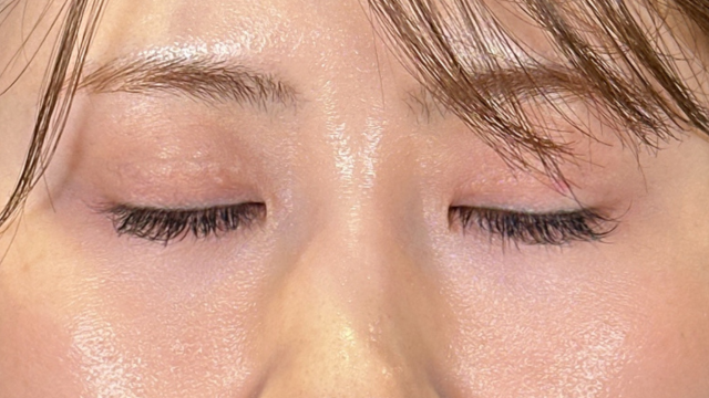 手术前的状态 其一